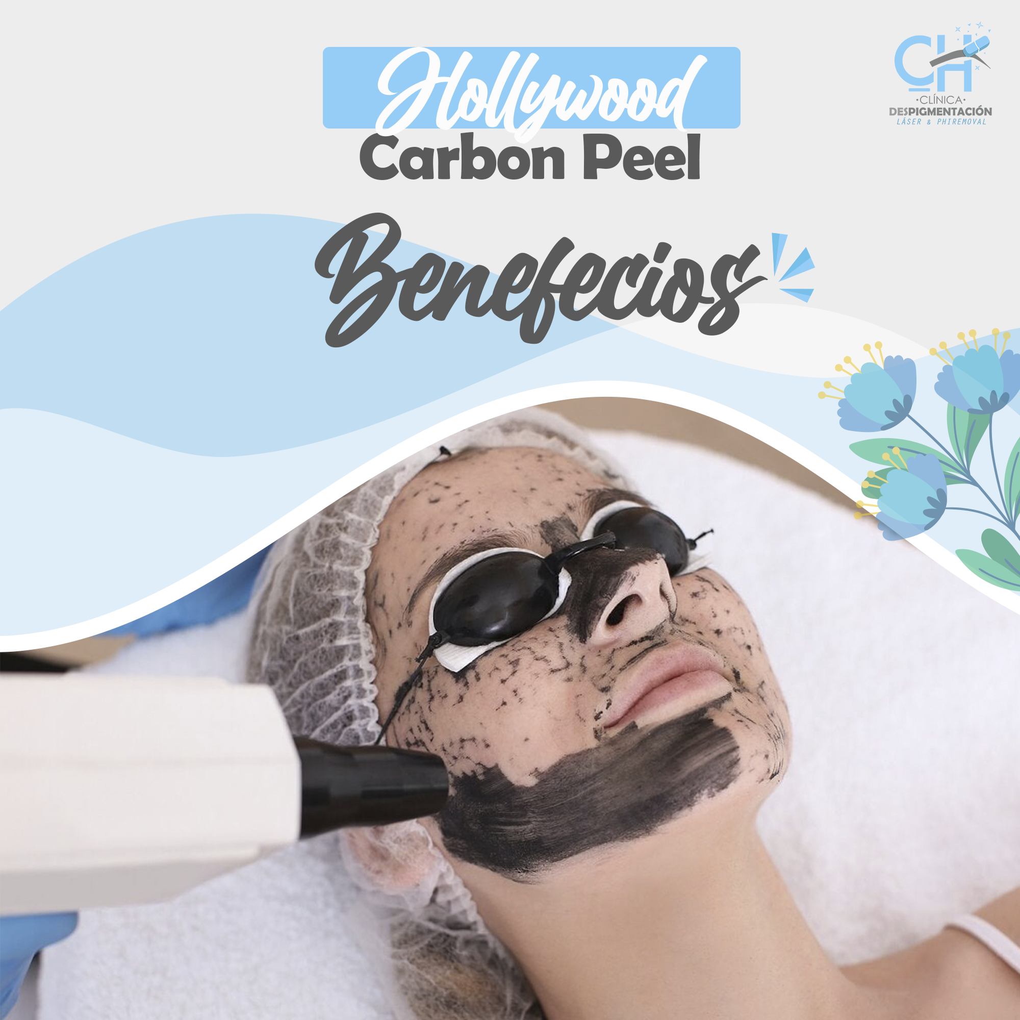 Hollywood Carbon Peel